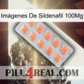 Imágenes De Sildenafil 100Mg 26